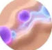 Purifica tu piel con ozono para acelerar la curación.